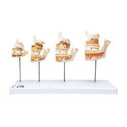 Maquette de développement de la dentition